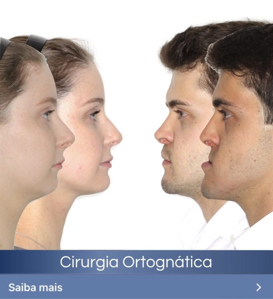 cirurgia ortognática